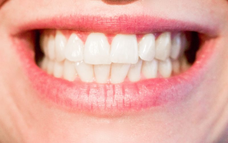 Perfekt weiße Zähne