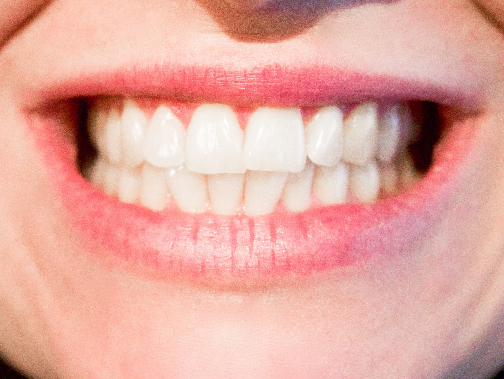 Perfekt weiße Zähne